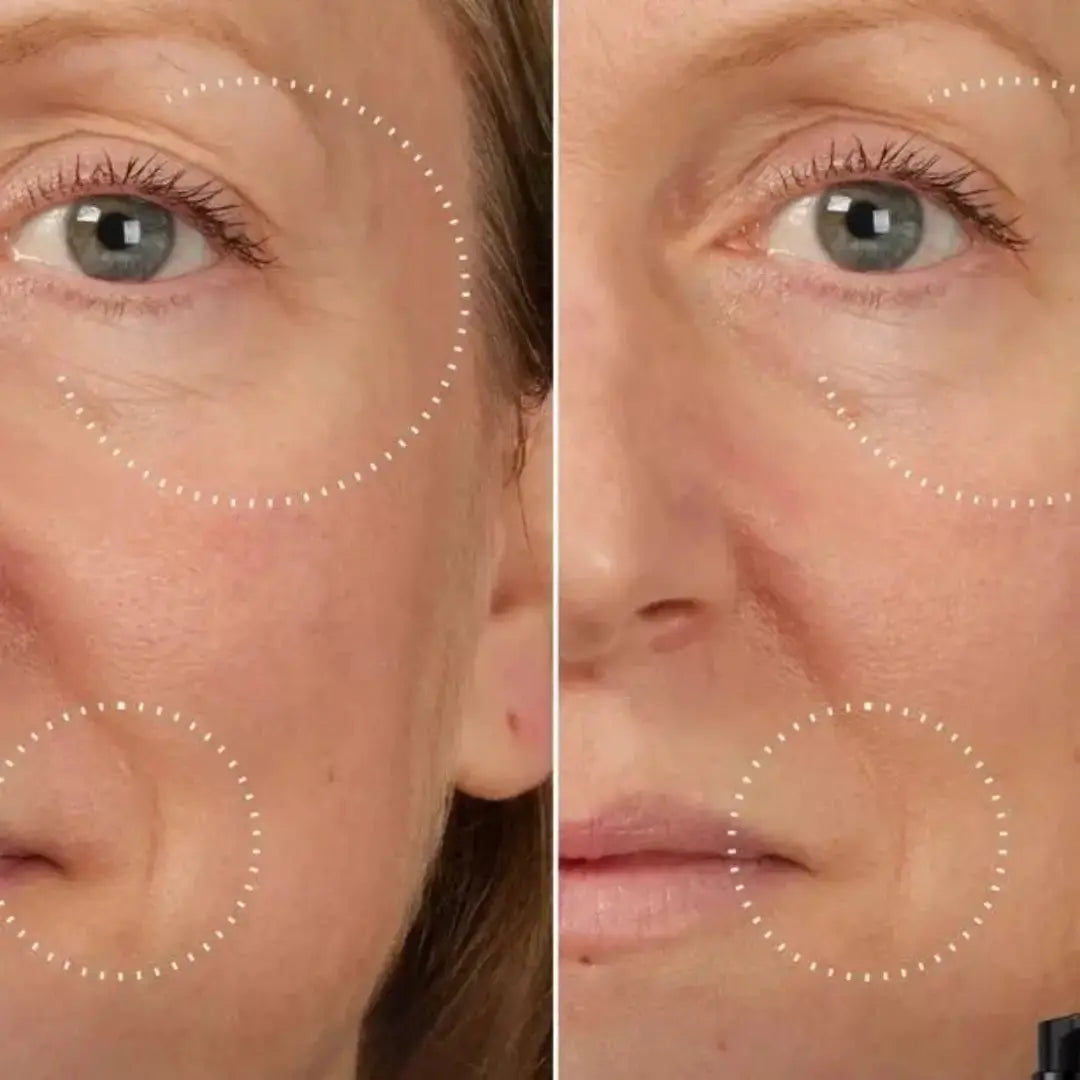SkinLift™ Botox Serum - Synligt yngre hud på 14 dage.
