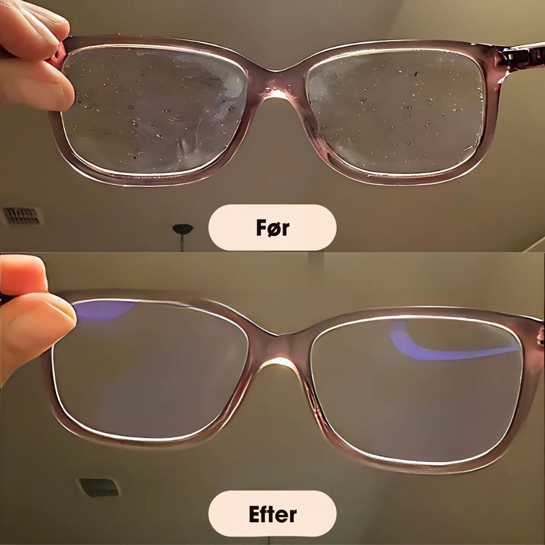 OptiClear® - Se Loveleiere med ultralydsLoveleiseLovelei