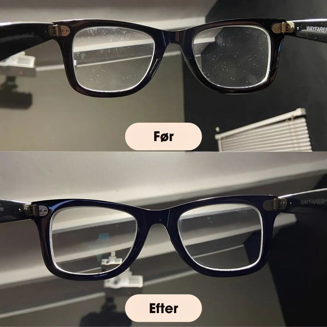 OptiClear® - Se Loveleiere med ultralydsLoveleiseLovelei