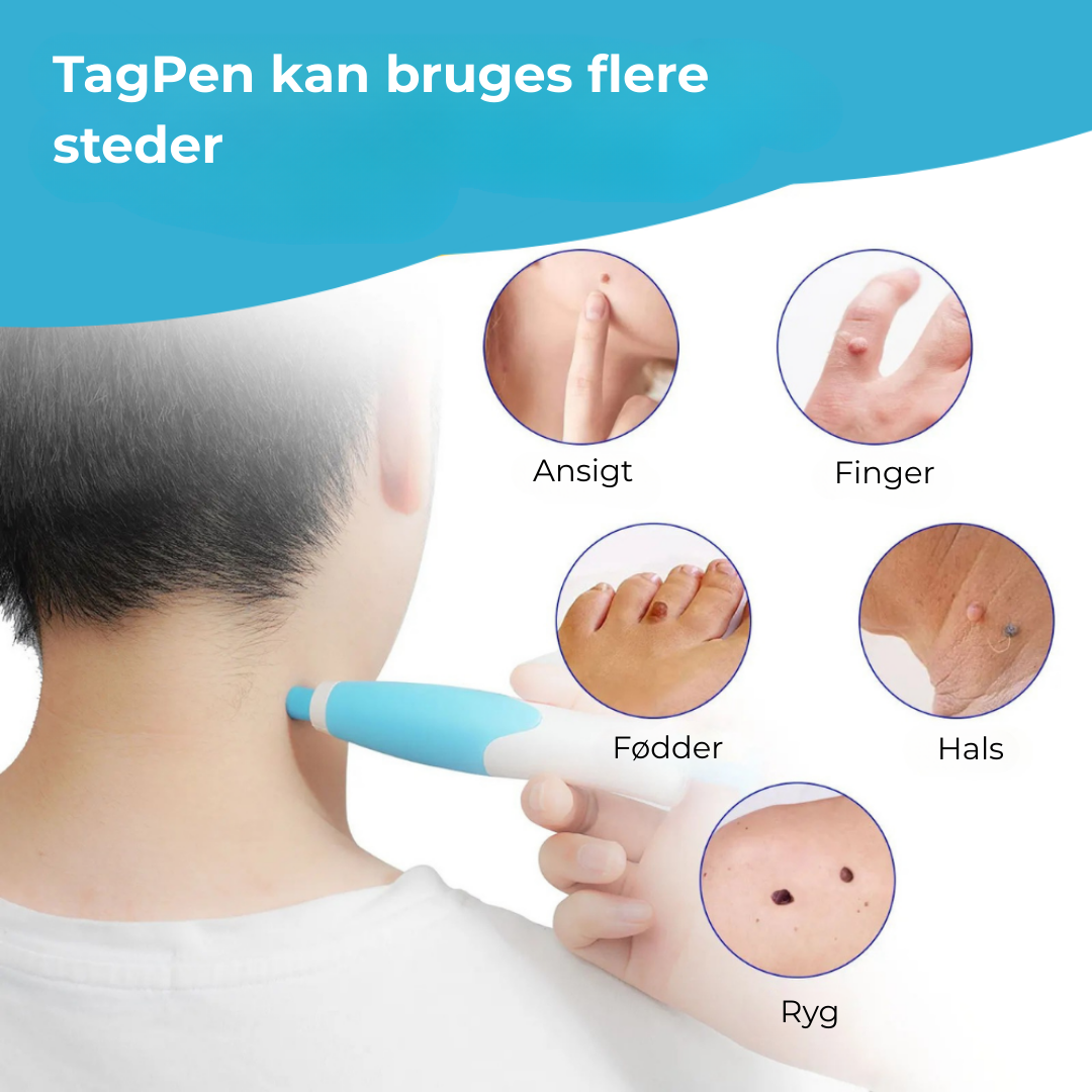 SkinEase™ Pen – Lovelei fjernelse af hudmærker!
