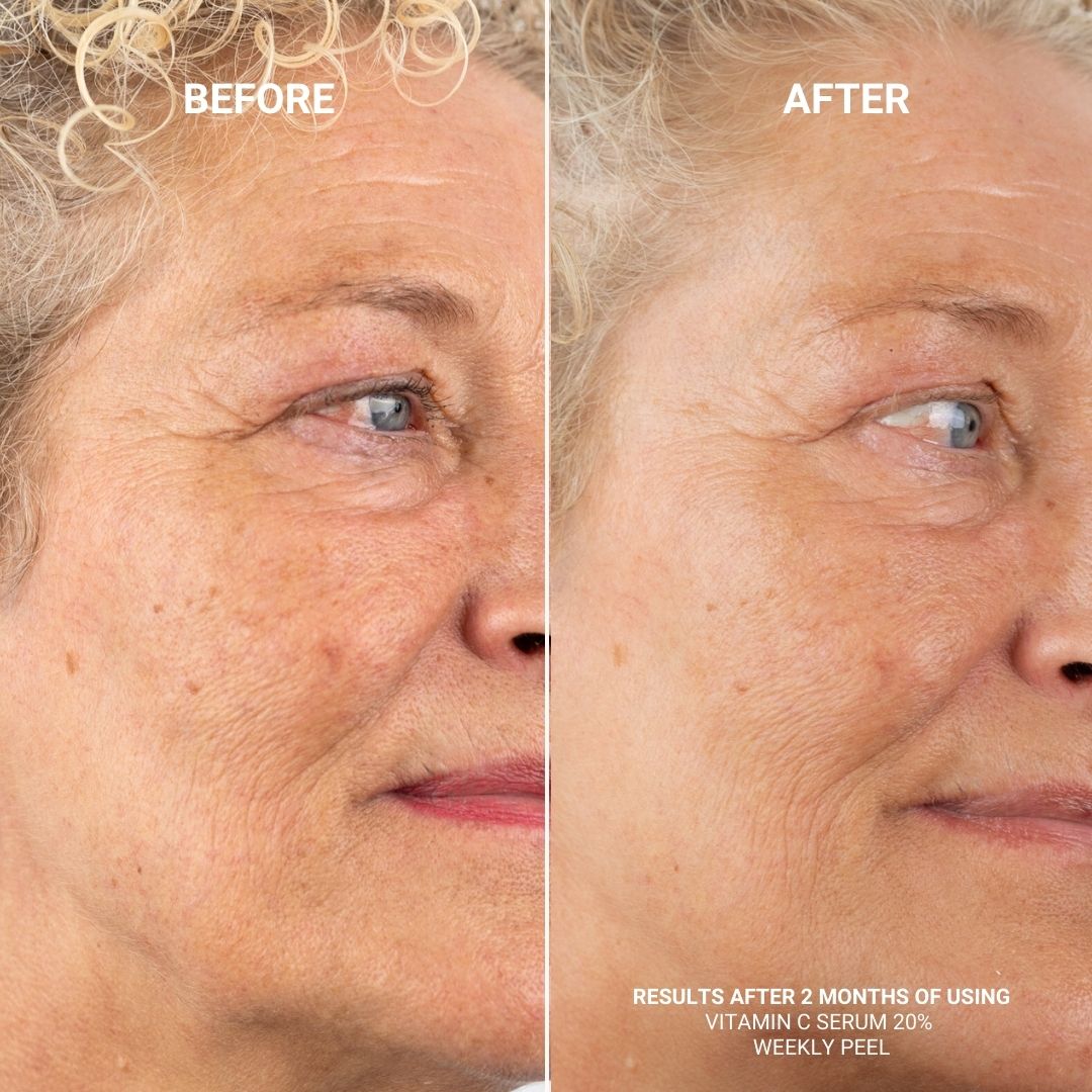 VITAMIN C SERUM 20%
