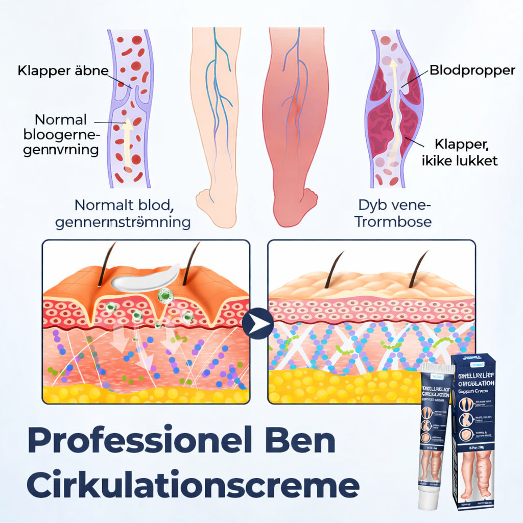 BenRo™ – LindLoveleide bencreme til lette ben og bedre blodcirkulation