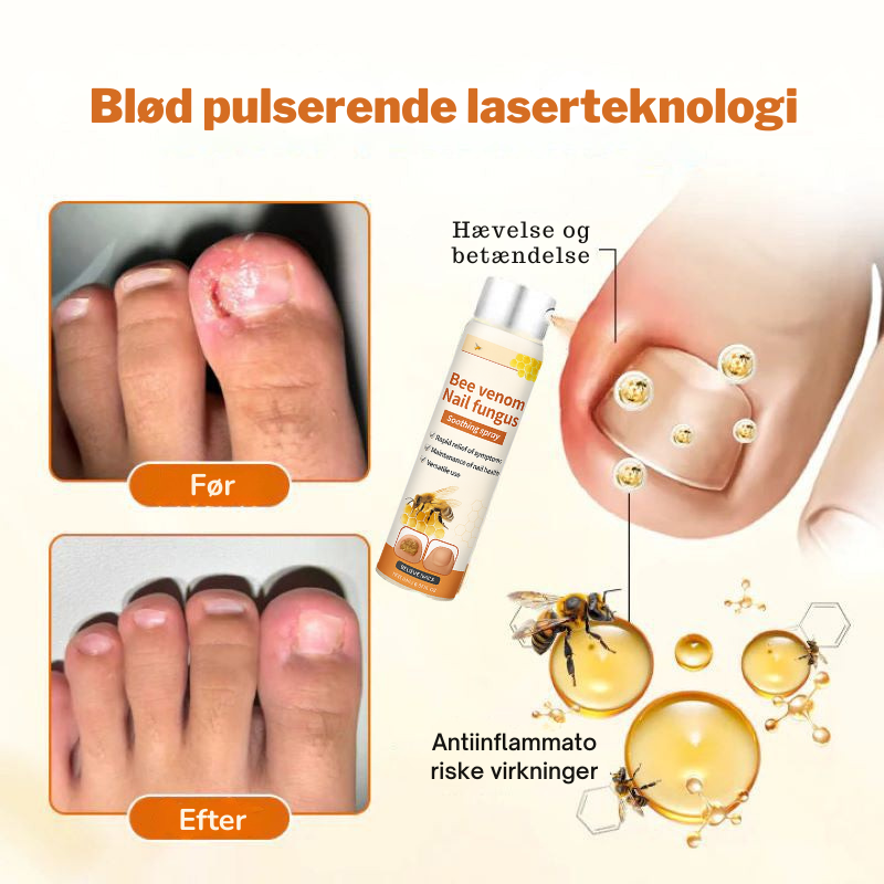 LoveleiNegl™ – Avanceret Svampedræbende Loveleiplejespray