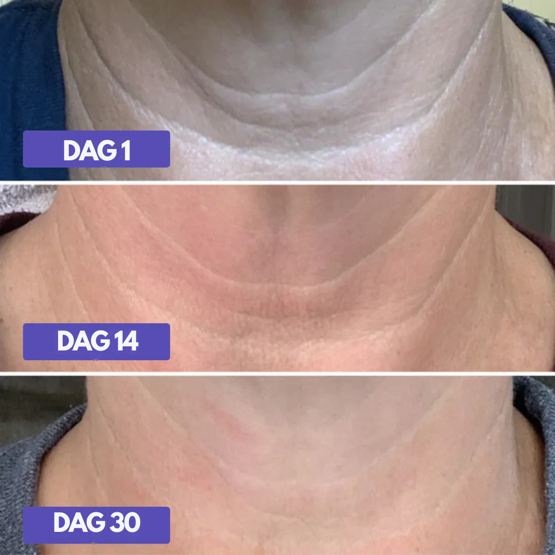 HalsLøft™ – OpLoveleimende Hals- & Dekolletagecreme